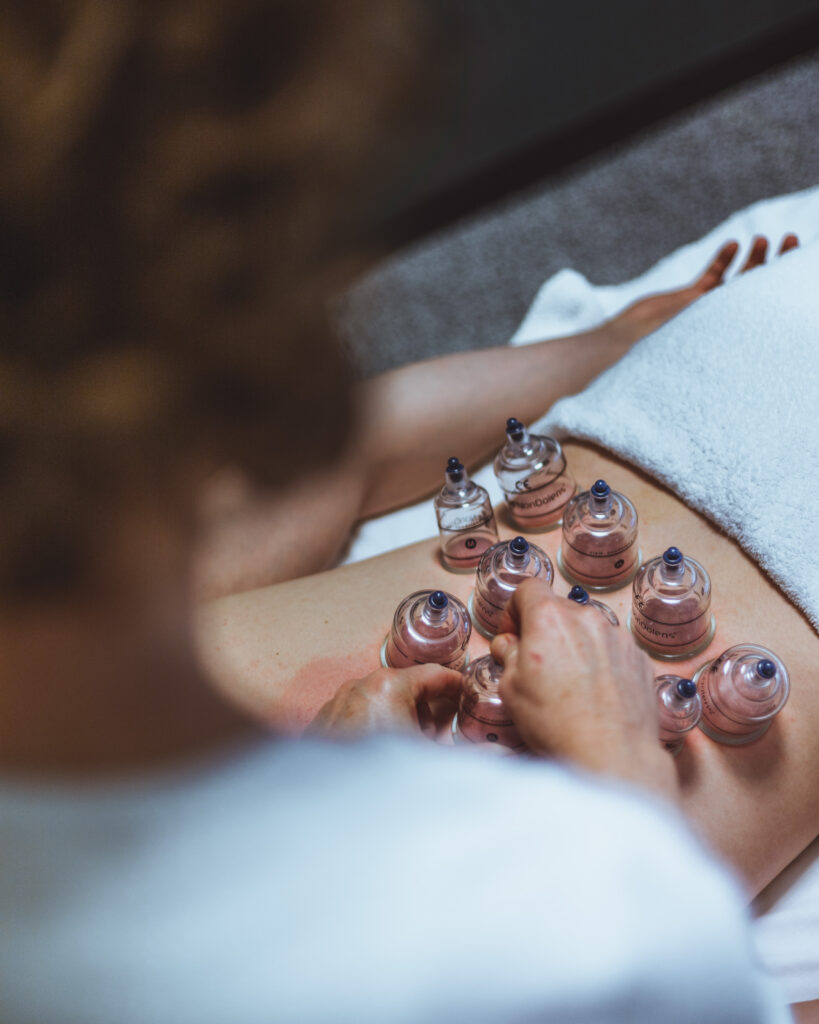 Cupping for lændesmerter