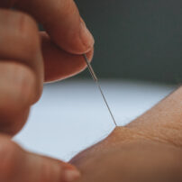 Moderne akupunktur acunova
